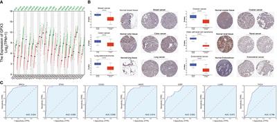 GPX3 expression was down-regulated but positively correlated with poor outcome in human cancers